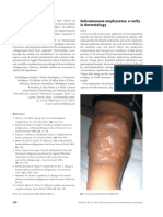 Subcutaneous Emphysema A Rarity in Dermatology 2007