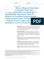 Localised Periodontitis With Trauma From Occlusion