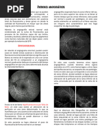 Patrones Angiográficos