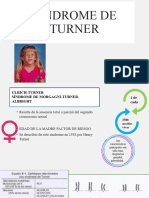 Sindrome de Turner