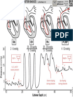 Pulmonary Artery Catheter Basics