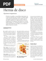 Hernia de Disco