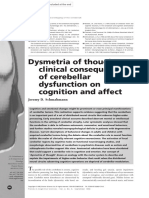 Dysmetria of Thought Clinical Consequences of Cer