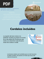 Cordales Incluidos Patologia Clinica y Tratamiento Del Tercer Molar Incluido