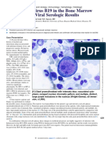 Human Parvovirus B19 in The Bone Marrow