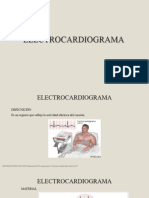 Electrocardiogram A