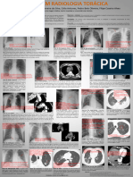 Sinais em Radiologia Torã - Cica