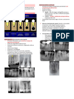 17 - Lesões Periapicais