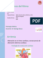 Fibrilación Auricular y Otros Trastornos Del Ritmo