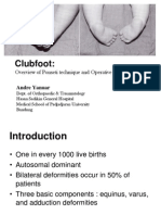 Clubfoot