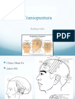 Cranio - Acupuntura:cranio, Rino e Faciopuntura