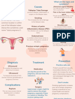 Ectopic Pregnancy