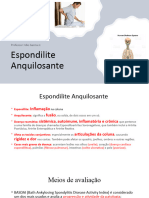 Espondilite Anquilosante