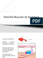 Distrofia Muscular de Duchenne