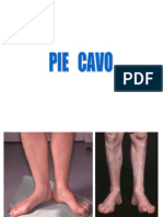 Clase Pie Cavo