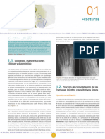 Fractura y Consolidacion