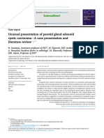 Unusual Presentation of Parotid Gland Adenoid