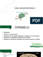 Estructura Infratentorial Ok