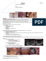 Endometriose