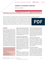 Orofacial Manifestations of Systemic Sclerosis