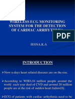 Wireless Ecg Monitoring System For The Detection of Cardiac Arrhythmia