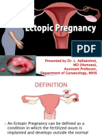 Ectopic Pregnancy