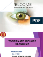 Topiramate Induced Glaucoma