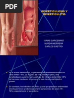 Diverticulosis y Diverticulitis