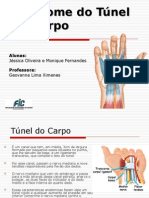 Sindrome Do Tunel Do Carpo