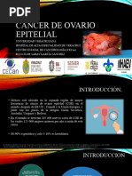 Cancer de Ovario Epitelial