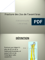 Fracture Avant Bras