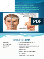 CASE PRESENTATION ON Viral Hepatitis