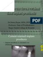 Cement Versus Screw Retained Implant Prostheses