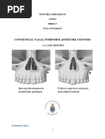 Pyriform Aperture Stenosis