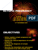 Ectopic Pregnancy