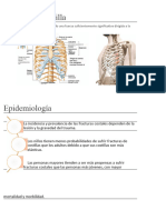 Fractura de Costilla