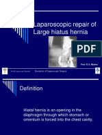 Laparoscopic Repair of Hiatus Hernia