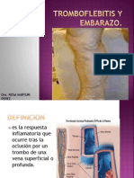 Tromboflebitis y Embolismo