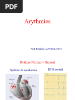 (Cours2) Lancellotti Arythmies 2024