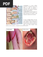 Fases de La Herida