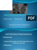 HISTEROSALPINGOGRAFIA JP