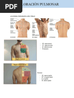 Anatomía Topográfica Del Tórax