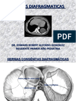 Hernias Diafragmaticas Edward