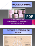 ELECTROCARDIOGRAMME