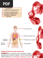 Drépanocytose