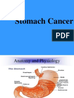 Stomach Cancer