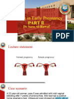 Ectopic Pregnancy