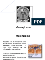 Meningiomas