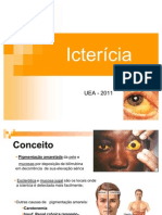 Ictericia