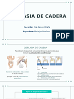 Displasia Congenita de Cadera